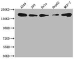 PLXNB2 Polyclonal Antibody