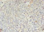 PMM1 Polyclonal Antibody