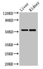 PNLIPRP3 Antibody in Western Blot (WB)