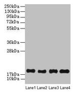PPIAL4G Antibody in Western Blot (WB)