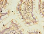 PPM1D Polyclonal Antibody