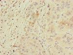 PPM1D Antibody in Immunohistochemistry (Paraffin) (IHC (P))