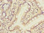 PPM1D Polyclonal Antibody