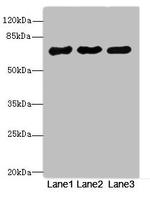 PPM1D Antibody in Western Blot (WB)