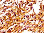 PPM1F Antibody in Immunohistochemistry (Paraffin) (IHC (P))