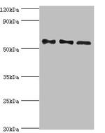 PPP3CC Antibody in Western Blot (WB)
