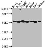 PRAMEF6 Polyclonal Antibody