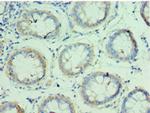 QARS Polyclonal Antibody