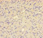 QPCT Polyclonal Antibody