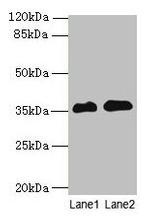 RFPL3 Polyclonal Antibody