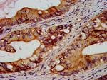 RGS6 Antibody in Immunohistochemistry (Paraffin) (IHC (P))