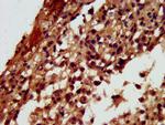 RGS6 Antibody in Immunohistochemistry (Paraffin) (IHC (P))