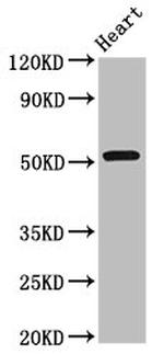 RGS6 Antibody in Western Blot (WB)