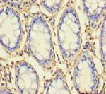 RHBDL2 Polyclonal Antibody