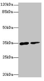 RNF148 Antibody in Western Blot (WB)