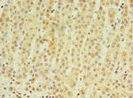 RNF212 Polyclonal Antibody
