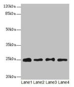 RPS8 Polyclonal Antibody