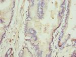 Rhotekin Polyclonal Antibody