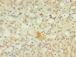 SERPINB8 Polyclonal Antibody