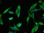SLFN11 Polyclonal Antibody