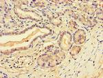 SLFN11 Antibody in Immunohistochemistry (Paraffin) (IHC (P))