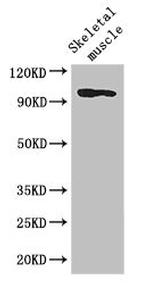 SLFN11 Antibody in Western Blot (WB)
