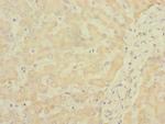 SOAT2 Antibody in Immunohistochemistry (Paraffin) (IHC (P))