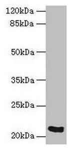 SPCS3 Antibody in Western Blot (WB)