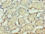 SSSCA1 Antibody in Immunohistochemistry (Paraffin) (IHC (P))