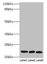 SSSCA1 Antibody in Western Blot (WB)