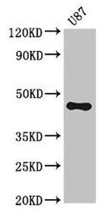 ST8SIA5 Antibody in Western Blot (WB)