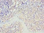 STK16 Antibody in Immunohistochemistry (Paraffin) (IHC (P))