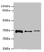 STK16 Antibody in Western Blot (WB)