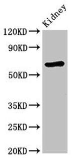 STXBP3 Antibody in Western Blot (WB)