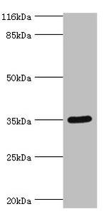 SULT1B1 Antibody in Western Blot (WB)