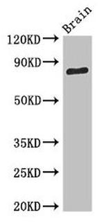SV2B Antibody in Western Blot (WB)