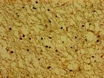 Synaptoporin Antibody in Immunohistochemistry (Paraffin) (IHC (P))