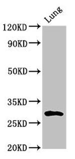 Synaptoporin Antibody in Western Blot (WB)