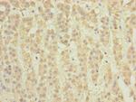 TCTA Polyclonal Antibody