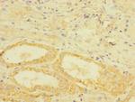 TGFBR3 Polyclonal Antibody