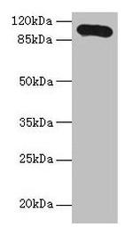 Thrombospondin 3 Polyclonal Antibody