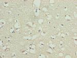 TMCC1 Antibody in Immunohistochemistry (Paraffin) (IHC (P))