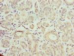 TMCC1 Antibody in Immunohistochemistry (Paraffin) (IHC (P))