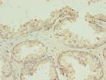 TMEM141 Polyclonal Antibody