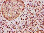 TMEM14A Antibody in Immunohistochemistry (Paraffin) (IHC (P))