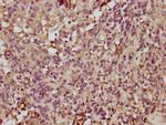 TMEM14A Antibody in Immunohistochemistry (Paraffin) (IHC (P))