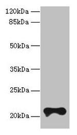 TMEM154 Antibody in Western Blot (WB)