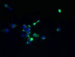 TMEM174 Antibody in Immunocytochemistry (ICC/IF)
