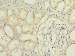 TMEM174 Antibody in Immunohistochemistry (Paraffin) (IHC (P))