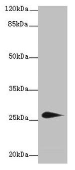 TMEM174 Antibody in Western Blot (WB)